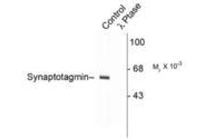 Image no. 1 for anti-Synaptotagmin I (SYT1) (pThr202) antibody (ABIN228043) (SYT1 antibody  (pThr202))