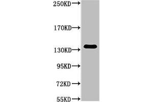 Western blot analysis of Hela, diluted at 1:1000. (COL3A1 antibody)