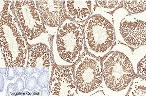 Immunohistochemical analysis of paraffin-embedded rat testis tissue. (NF-kB p65 antibody  (acLys310))