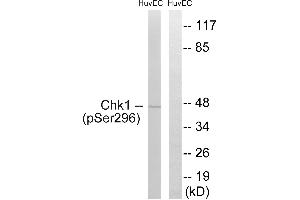 Western blot analysis of extracts from HUVEC cells, treated with UV (15 mins), using Chk1 (Phospho-Ser296) antibody. (CHEK1 antibody  (pSer296))