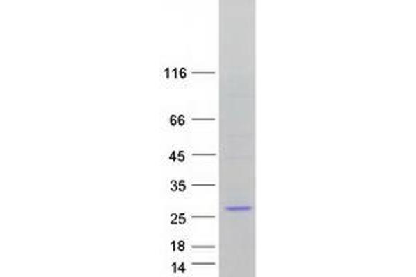 DCTN3 Protein (Transcript Variant 1) (Myc-DYKDDDDK Tag)