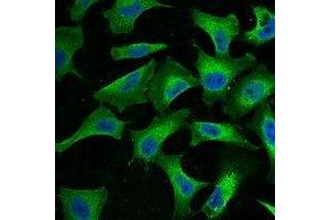 Immunofluorescent analysis of EGFR staining in Hela cells. (EGFR antibody)