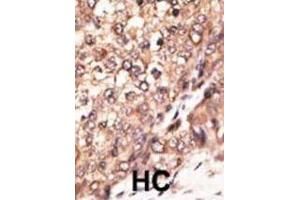 Immunohistochemistry (IHC) image for anti-Bone Morphogenetic Protein 7 (BMP7) antibody (ABIN2999272) (BMP7 antibody)