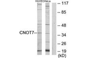 Western Blotting (WB) image for anti-CCR4-NOT Transcription Complex, Subunit 7 (CNOT7) (AA 10-59) antibody (ABIN2889800) (CNOT7 antibody  (AA 10-59))