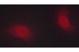 ABIN6267222 staining HeLa cells by ICC/IF. (CHEK1 antibody  (pSer286))