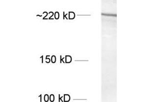 Western Blotting (WB) image for anti-Nestin (NES) antibody (ABIN1742563) (Nestin antibody)