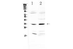 Western blot analysis of MyD88 using anti-MyD88 antibody . (MYD88 antibody  (AA 14-263))