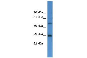 WB Suggested Anti-SPR Antibody Titration: 0. (SPR antibody  (C-Term))