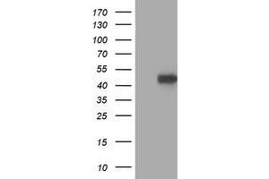 HEK293T cells were transfected with the pCMV6-ENTRY control (Left lane) or pCMV6-ENTRY PRKAR1B (Right lane) cDNA for 48 hrs and lysed. (PRKAR1B antibody)