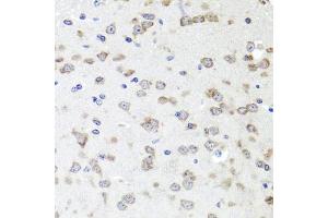 Immunohistochemistry of paraffin-embedded mouse brain using IGFBP5 antibody (ABIN6292146) at dilution of 1:100 (40x lens). (IGFBP5 antibody)