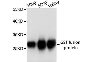 Western blot analysis of over-expressed GST fusion protein using GST-tag antibody. (GST antibody)