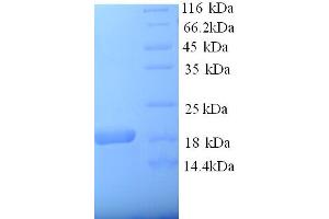 SDS-PAGE (SDS) image for alpha-2-Macroglobulin (A2M) (AA 620-750), (partial) protein (His tag) (ABIN5713188) (alpha 2 Macroglobulin Protein (AA 620-750, partial) (His tag))