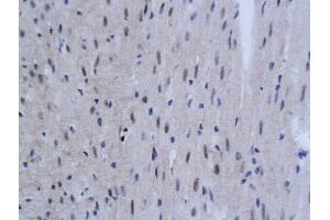 Formalin-fixed and paraffin embedded mouse myocardial tissue labeled with Anti SnoN Polyclonal Antibody, Unconjugated  followed by conjugation to the secondary antibody and DAB staining (SKIL antibody  (AA 301-400))