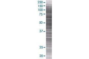 PCYOX1L transfected lysate. (PCYOX1L 293T Cell Transient Overexpression Lysate(Denatured))