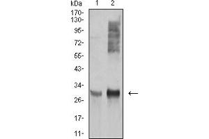 Western Blotting (WB) image for anti-HLA Class II DR alpha (HLA-DRA) (AA 26-254) antibody (ABIN5920848) (HLA-DRA antibody  (AA 26-254))