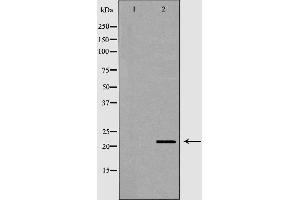 Western blot analysis of MCF-7  lysate using RNASE11 antibody. (RNASE11 antibody  (Internal Region))