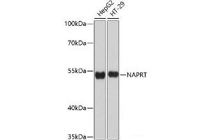 Western blot analysis of extracts of various cell lines using NAPRT Polyclonal Antibody at dilution of 1:3000. (NAPRT1 antibody)