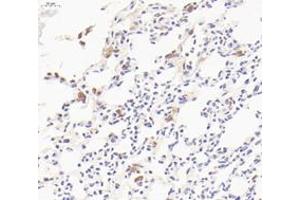 Immunohistochemistry analysis of paraffin-embedded mouse lung with LPS treated for 24h using CD206 (ABIN7074550) at dilution of 1: 800 (Mannose Receptor antibody)