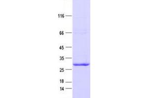 Validation with Western Blot (Patched 1 Protein (PTCH1) (DYKDDDDK Tag))