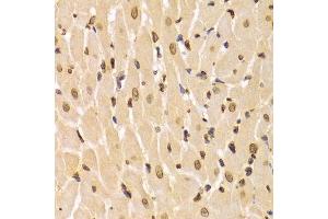 Immunohistochemistry (Paraffin-embedded Sections) (IHC (p)) image for anti-Lamin A/C (LMNA) (AA 403-572) antibody (ABIN3020785)