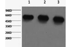 Western Blotting (WB) image for anti-alpha Tubulin (TUBA1) antibody (ABIN5962723) (alpha Tubulin antibody)