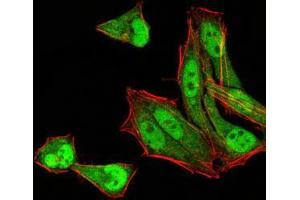 Immunofluorescence analysis of Hela cells using MGMT mouse mAb (green). (MGMT antibody  (AA 32-210))