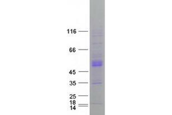 CLN3 Protein (Transcript Variant 1) (Myc-DYKDDDDK Tag)