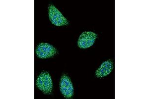 Confocal immunofluorescent analysis of SERPINA6 Antibody with 293 cell followed by Alexa Fluor 488-conjugated goat anti-rabbit lgG (green). (SERPINA6 antibody  (AA 197-225))