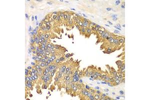 Immunohistochemistry of paraffin-embedded human prostate using DDX58 antibody. (DDX58 antibody)