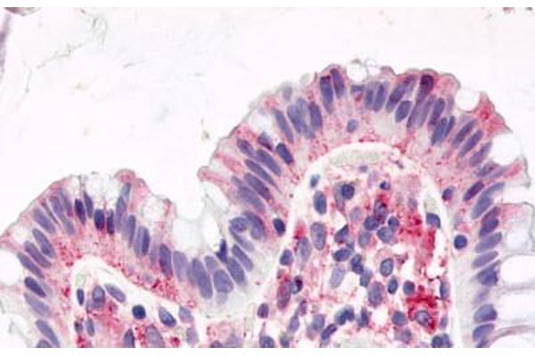 GPR15 anticorps  (Cytoplasmic Domain)