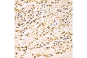 Immunohistochemistry of paraffin-embedded human kidney using TBL1XR1 antibody at dilution of 1:100 (x400 lens). (TBL1XR1 antibody)