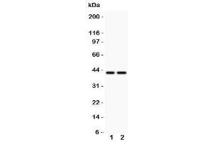 Western blot testing of CD244 antbody and  Lane 1: MCF-7 (2B4 antibody  (C-Term))