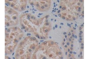 DAB staining on IHC-P; Samples: Human Kidney Tissue (CELSR3 antibody  (AA 1181-1421))