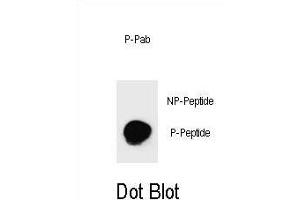Dot blot analysis of Phospho-RP1- Antibody Phospho-specific b (ABIN1539777 and ABIN2839900) on nitrocellulose membrane. (PARP1 antibody  (pSer782))