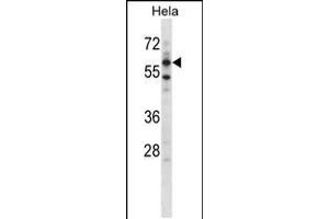 Western blot analysis in Hela cell line lysates (35ug/lane). (ADCK5 antibody  (N-Term))