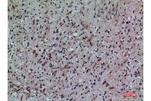 Immunohistochemistry (IHC) analysis of paraffin-embedded Human Brain, antibody was diluted at 1:100. (FCRL5 antibody  (Internal Region))