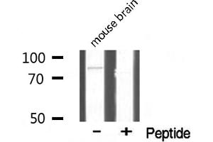 Western Blotting (WB) image for anti-T-Box 3 (TBX3) antibody (ABIN6265491)