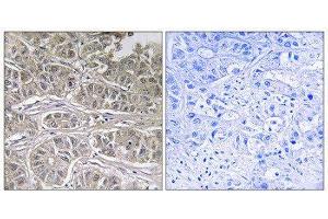 Immunohistochemistry (IHC) image for anti-Solute Carrier Family 25 (Mitochondrial Oxodicarboxylate Carrier), Member 21 (Slc25a21) (Internal Region) antibody (ABIN1851570) (SLC25A21 antibody  (Internal Region))
