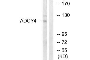 Western blot analysis of extracts from Jurkat cells, using ADCY4 antibody. (ADCY4 antibody)