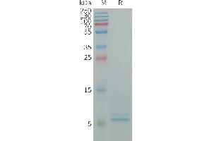 Human CD9 Protein, His Tag on SDS-PAGE under reducing condition. (CD9 Protein (CD9) (AA 112-195) (His tag))