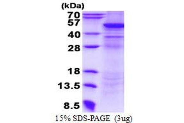 UQCRC2 Protein (His tag)