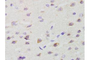 Formalin-fixed and paraffin embedded rat brain labeled with Anti-GALR2 Polyclonal Antibody, Unconjugated (ABIN1386167) at 1:200 followed by conjugation to the secondary antibody and DAB staining (GALR2 antibody  (AA 51-150))