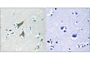 Immunohistochemistry (IHC) image for anti-Dual Specificity Phosphatase 1 (DUSP1) (AA 318-367) antibody (ABIN2888897) (DUSP1 antibody  (AA 318-367))
