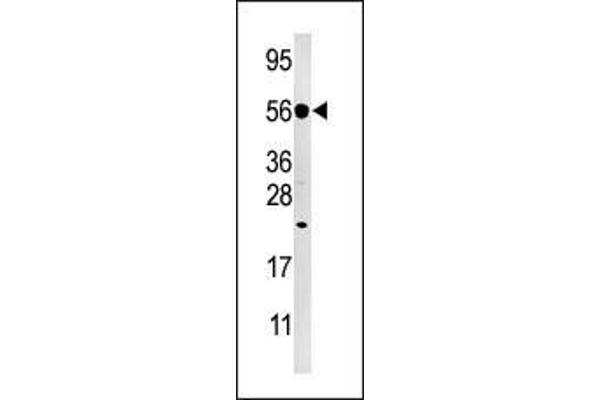 DUSP8 antibody  (C-Term)