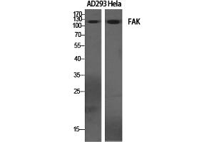 Western Blotting (WB) image for anti-PTK2 Protein tyrosine Kinase 2 (PTK2) (Tyr397) antibody (ABIN5960991) (FAK antibody  (Tyr397))