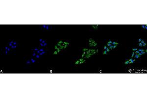 Immunocytochemistry/Immunofluorescence analysis using Rabbit Anti-p53 Polyclonal Antibody . (p53 antibody  (C-Term) (PE))