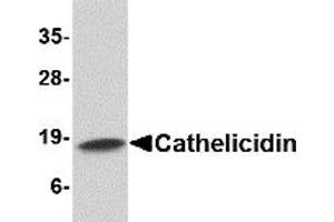 Western Blotting (WB) image for anti-Cathelicidin Antimicrobial Peptide (CAMP) (C-Term) antibody (ABIN1030321) (Cathelicidin antibody  (C-Term))