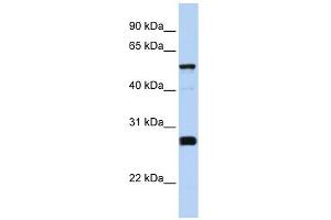 FAM83F antibody used at 1 ug/ml to detect target protein. (FAM83F anticorps  (Middle Region))