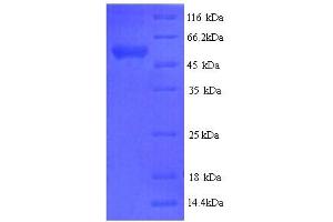 SDS-PAGE (SDS) image for Myelin Associated Glycoprotein (MAG) (AA 25-516), (Extracellular) protein (His tag) (ABIN5713622) (MAG Protein (AA 25-516, Extracellular) (His tag))