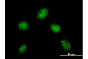 Immunofluorescence of monoclonal antibody to DYDC1 on HeLa cell. (DYDC1 antibody  (AA 1-177))